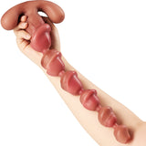 Dilatation douce et contrôlée